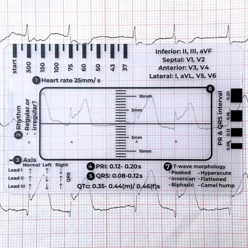 ECG 7-Step Guide Card